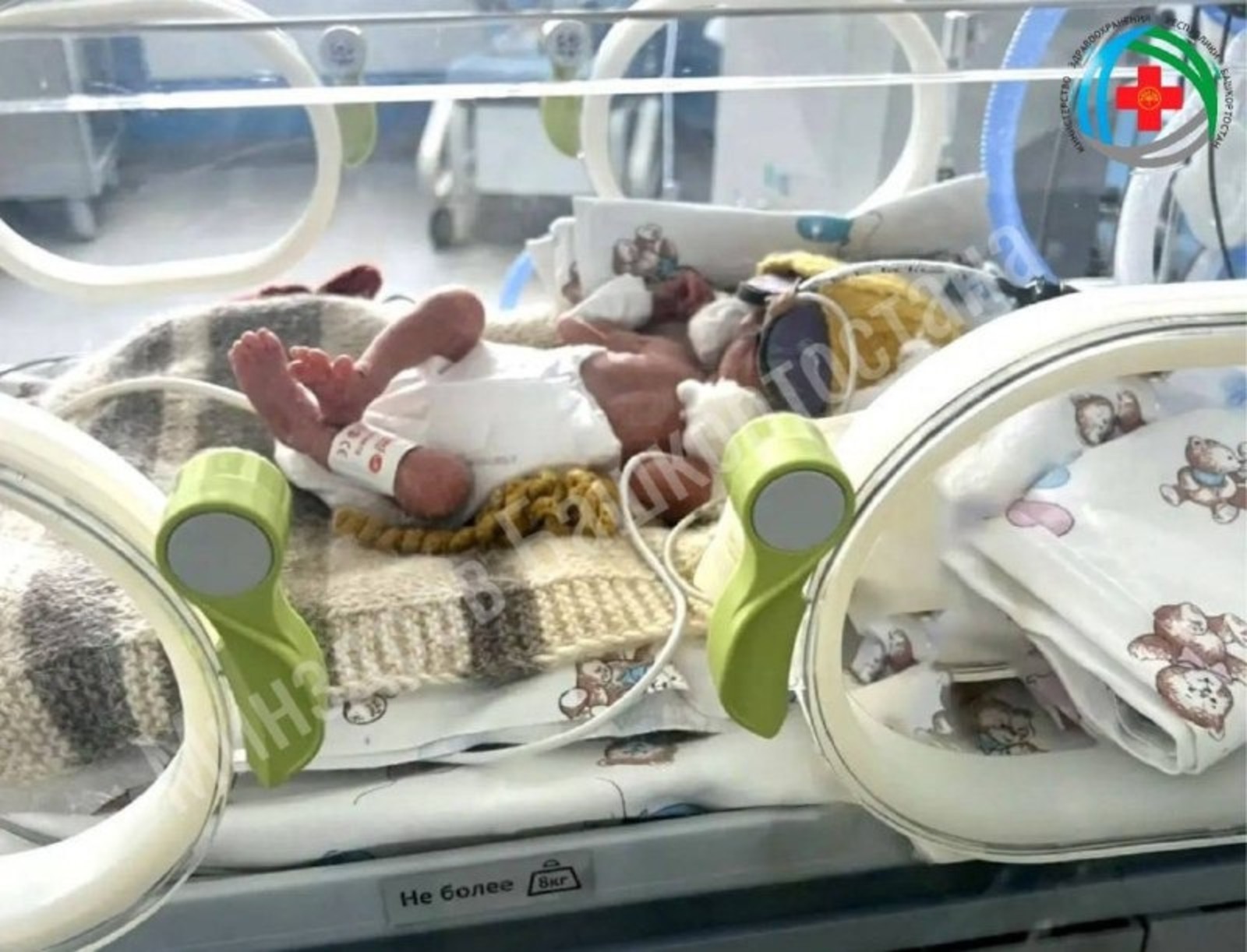 В Башкирии спасли девочку, родившуюся с весом 580 граммов