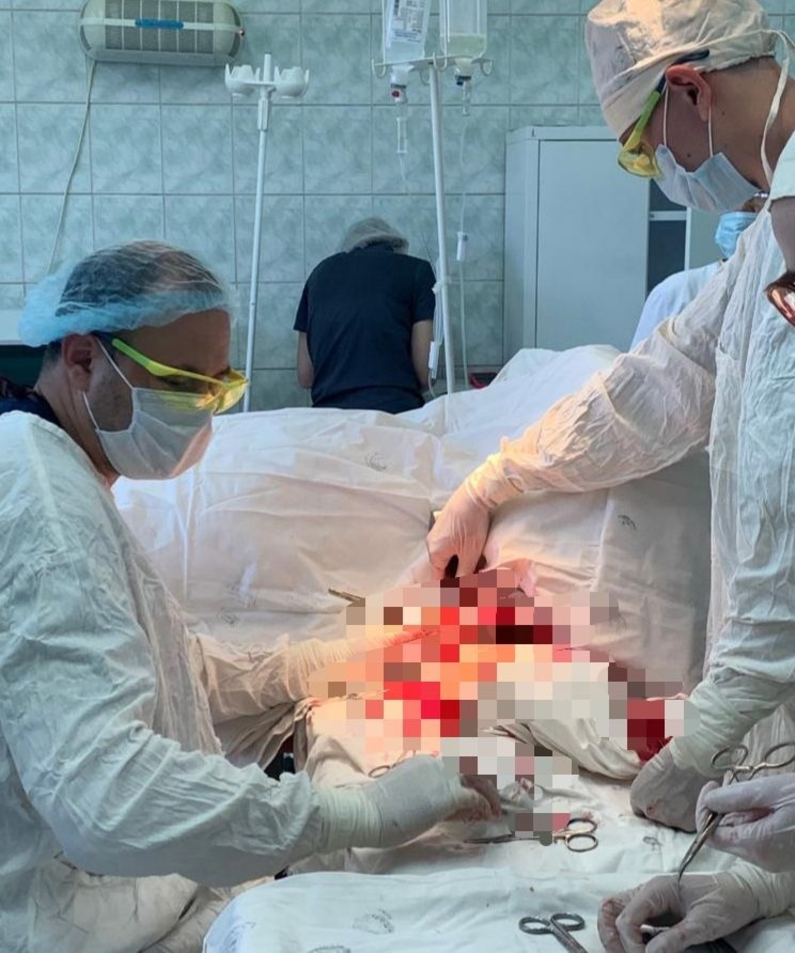 В КБ №1 Стерлитамака успешно прооперировали мужчину, тяжело травмированного бензопилой