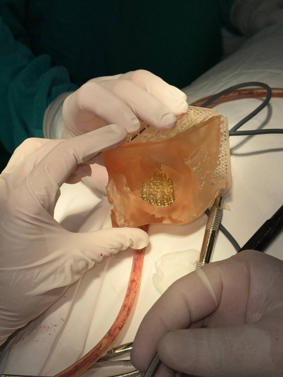 В Башкирии врачи восстановили часть лица бойцу СВО после боевой травмы